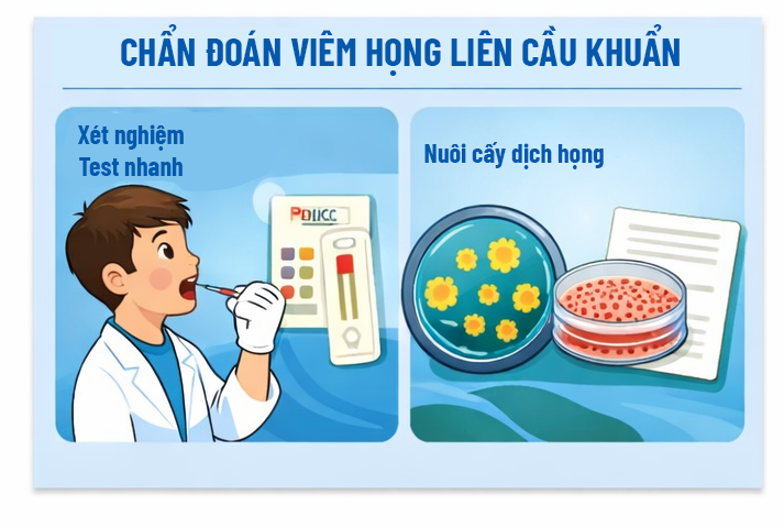 Kháng sinh chỉ được sử dụng khi có bằng chứng xác định trẻ bị viêm họng do liên cầu khuẩn