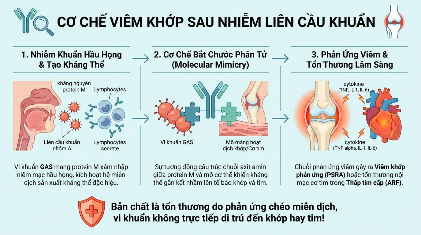Mối liên hệ giữa nhiễm trùng hầu họng và bệnh lý cơ xương khớp